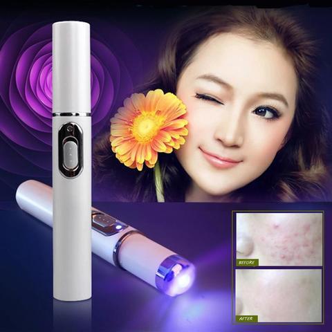 Acne Therapy Pen with Blue Light for Clearer Healthier Skin - My Store